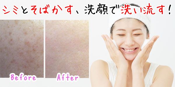 消 したい そばかす シミ